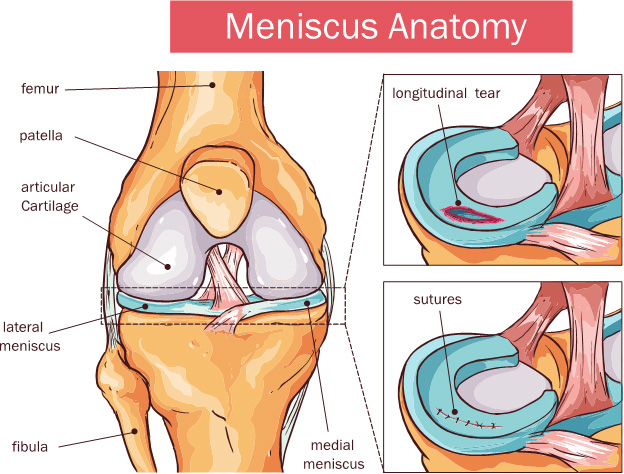 What Causes Lateral Knee Pain?